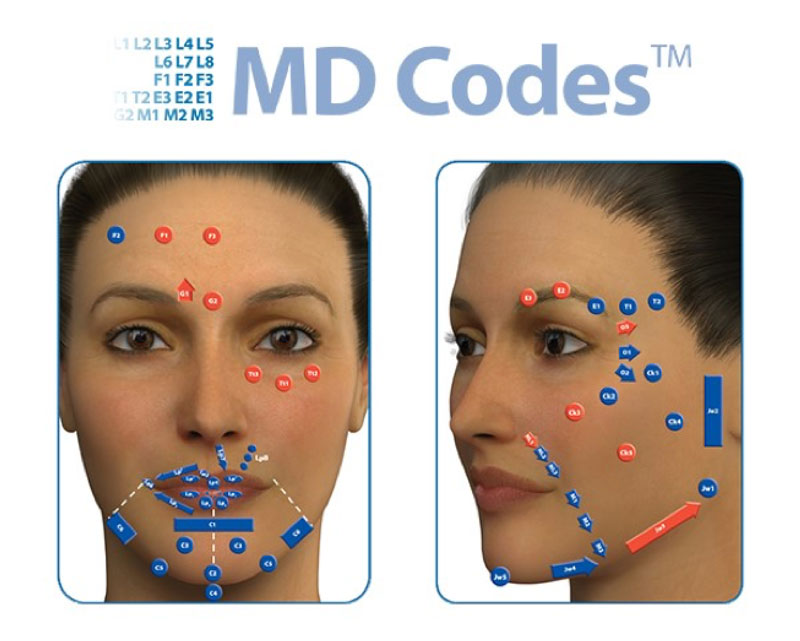 MD Codes acide hyaluronique injections